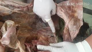 Dissection of Peritoneal Cavity by DrMeetu Agarwal [upl. by Calen]