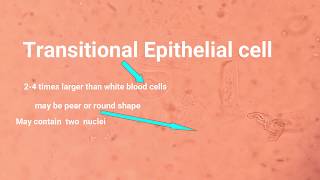 Epithelial cell types and its identification [upl. by Gem]