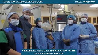 Stenting for Cerebral Venous Hypertension with Papilledema and IIH  IRFACILITIES [upl. by Assen]