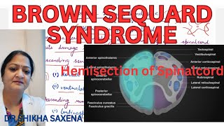 Brown Sequard Syndrome Hemisection of Spinal cord [upl. by Rosabel]