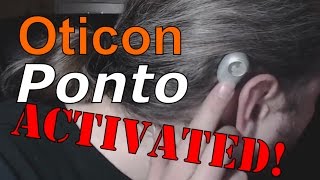 Oticon Ponto plus power  Activation of my bone anchored hearing aid [upl. by Ryter]