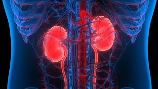 bladder cancer and urothelial tumors of upper urinary tract [upl. by Rohn]