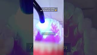 Cómo colocar un retenedor fijo 🤓☝🏽 odontologia smile ortodoncia odontology dientes boca [upl. by Ahter]