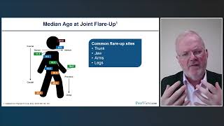 Can YOU Avoid Iatrogenic Harm Understanding and Identifying Fibrodysplasia Ossificans Progressiva [upl. by Nazler]