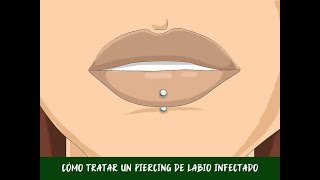 Cómo tratar un piercing de labio infectado [upl. by Rebor]