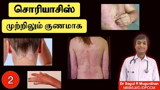 2 சொரியாசிஸ் முற்றிலும் குணமாக வழிகள்  உணவுமுறை  Psoriasis treatment  TAMIL [upl. by Echo252]