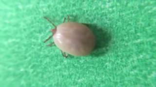 Tick Flicks  Deer Tick [upl. by Nwahsyt]