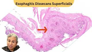 Theres nothing more satisfying in the esophagus than this diagnosis 🥳📚🔬 [upl. by Tad201]