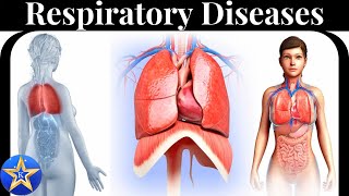 Respiratory Diseases Causes Diagnosis and Treatment [upl. by Aratahs284]