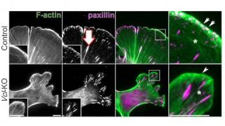 biosights July 8 2013  Vinculin delivers a clutch performance [upl. by Barrada673]