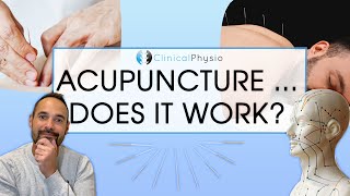 Does Acupuncture Work in Physiotherapy  Expert Physio Reviews the Evidence [upl. by Karilla474]