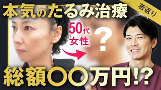 【40代・50代必見】最強の若返り治療を徹底解説！よくある失敗・やってはいけない美容整形とは？【若返り・アンチエイジング】 [upl. by Syd]