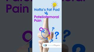 Hoffa’s Fat Pad vs Patellofemoral Pain physicaltherapy physiotheraphy kneepain [upl. by Terchie503]