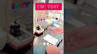 cbc test procedure in laboratory shorts cbctest [upl. by Eneliak]