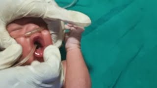 new born baby ne liya जन्म 2 June 2024 ko [upl. by Aiello405]