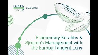 Filamentary Keratitis amp Sjögren’s Management with the Europa Tangent Lens [upl. by Neehcas413]