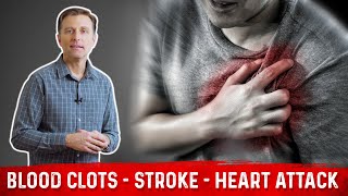 How to Prevent Blood Clots Strokes amp Heart Attacks – Tips by Dr Berg [upl. by Idid]