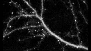 Synaptic development of cultured rat neuron [upl. by Towne145]