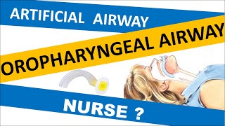 OROPHARYNGEAL AIRWAY INSERTION PROCEDURE  OPA  Artificial Airway  Oral Airway  Airway adjuncts [upl. by Cutcliffe324]