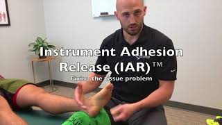 Plantar Fasciitis and Heel Pain Relief in Libertyville [upl. by Ydnas]