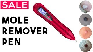 5 Best Mole Remover Pen Review  Skin Tag Removal Pen [upl. by Pattie]