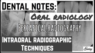 PERIAPICAL RADIOGRAPHY  INTRAORAL RADIOGRAPHIC TECHNIQUES  ORAL RASIOLOGY [upl. by Gonzalez]