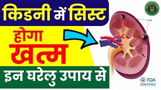 How To Cure Kidney Cyst Naturally  Polycystic Kidney Treatment  Kidney Treatment In Ayurveda [upl. by Areek256]