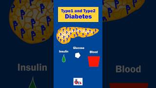 Type1 and Type 2 Diabetes  Know the difference DrTulip  JP Nagar [upl. by Arvell]