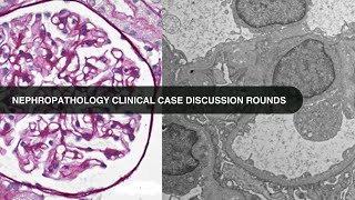 20230221 Nephropathology Clinical Case Discussion Rounds [upl. by Labors80]