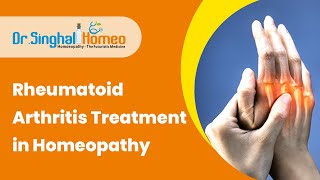 Homeopathic Treatment for Rheumatoid Arthritis  Dr Vikas Singhal HomeoDoctor [upl. by Novahs]