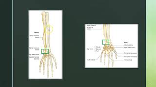 Chapitre 3 Atteinte du nerf ulnaire [upl. by Shanda]