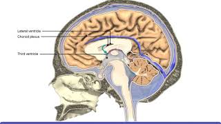 Choroid plexus cyst [upl. by Charita]