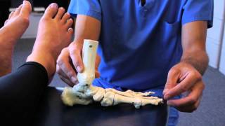 Spread Your Toes™ Series Flat Feet Conservative Care vs Conventional Care [upl. by Gemperle]