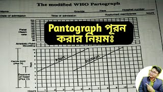 Partograph Kivabe Kore  How to Plot Partograph in Bangla [upl. by Gadmon]