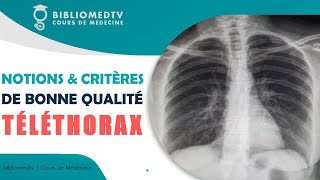 Radiographie du Thorax  Notions et Critères de Bonne Qualité [upl. by Oiziruam132]