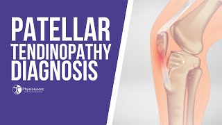 How to Diagnose Patellar Tendinopathy  Jumpers Knee Diagnosis [upl. by Raychel783]