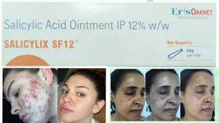 SALICYLIX SF12 Ointment Cream Salicylic Acid Ointment IP 12 ww [upl. by Nidraj]