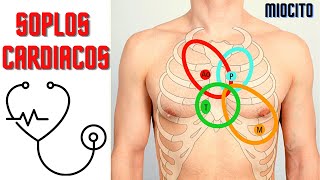 ♐SOPLOS CARDIACOS 🎓 SEMIOLOGIA FACIL 🎓 Memorización  Mnemotecnia [upl. by Ledif980]