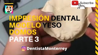 Prótesis Superior Sobredentadura 👅Parte3 Impresión Alginato y Modelo Yeso Domos [upl. by Threlkeld]