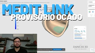 Odontologia Digital  Como Criar um Provisório Oco no Software Medit Link Dente 21 [upl. by Chilt281]