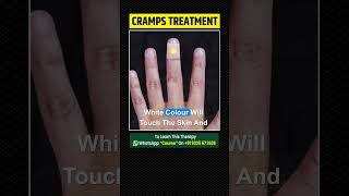 Cramps Treatment at Home  Acupressure Treatment [upl. by Vincent]