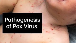 Pathogenesis of Pox Virus [upl. by Azarria]