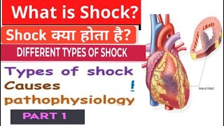 Types of shock in nursingpathology causes clinical features of shock full explanation [upl. by Oglesby]