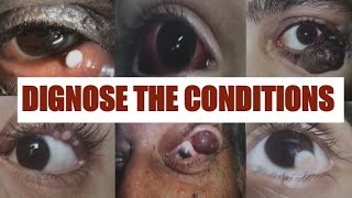 PATHOLOGICAL EYE CONDITIONS 1 Ophthalmology Osce [upl. by Tito]