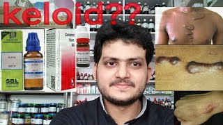 KeloidHomeopathic medicine for keloid explain [upl. by Naedan]