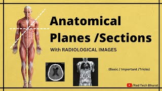 Anatomical Planes Sections and its Importance in Radiology Department [upl. by Azelea842]