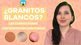 Quistes de millium o milia lo básico que debes de saber  Tips [upl. by Berti918]