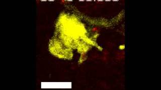 A dermal dendrite cell containing multiple vacuoles capturing an Leishmania parasite [upl. by Enirol]