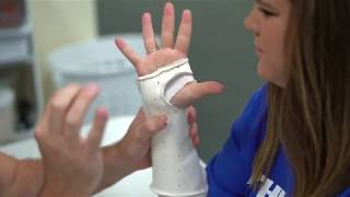 Carpal vs Cubital Tunnel Syndrome [upl. by Namreg]