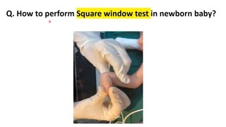 Square Window Test  Newborn Examination  Pediatrics [upl. by Htehpaj]